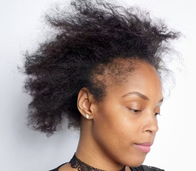 Top-Rated Hair Growth Oil for Thinning Hair South Africa: Complete Guide to Stronger, Fuller Hair 3 Top-Rated Hair Growth Oil for Thinning Hair