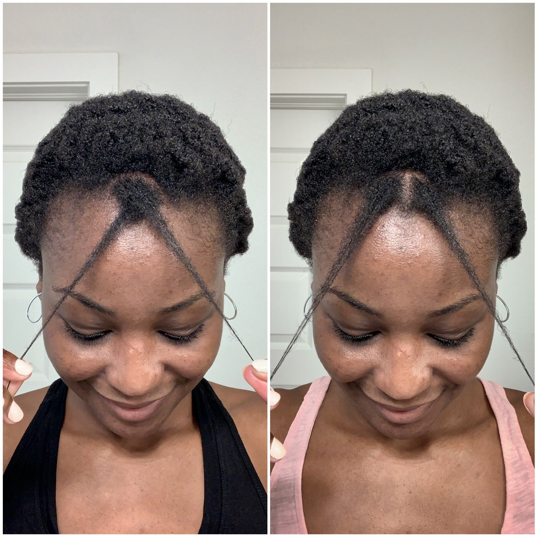 Hair Growth vs Length Retention: Why Your Hair Isn’t Getting Longer 3 hair growth vs now